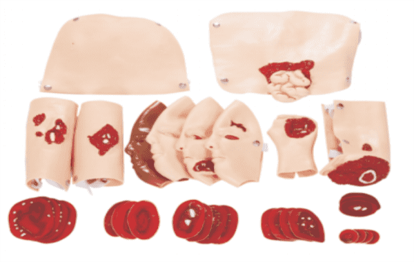 Wound Assessment Module （34 pcs）